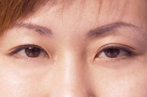 港北区の地域密着型皮膚科クリニック